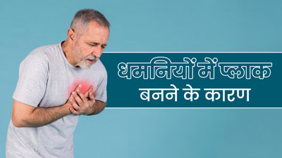 धमनियों में कैसे बनता है प्लाक? एक्सपर्ट से जानें इसे साफ करने के तरीके 
