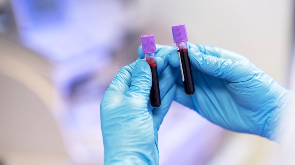 Govt Says 4.71 Cr Women Screened for Cervical Cancer, But HPV Affects Men Too: What You Need To Know