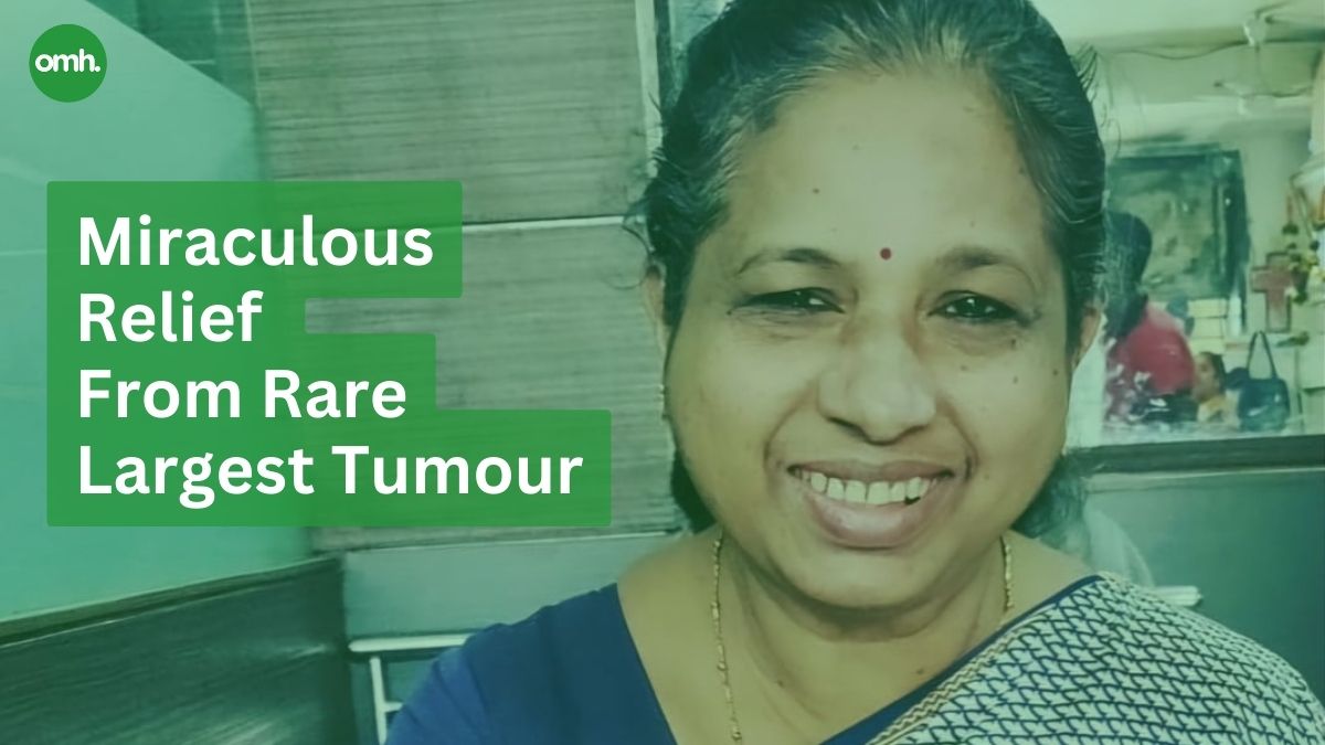 63-Year-Old Gets Miraculous Relief From Rare Largest Tumour On Her ...