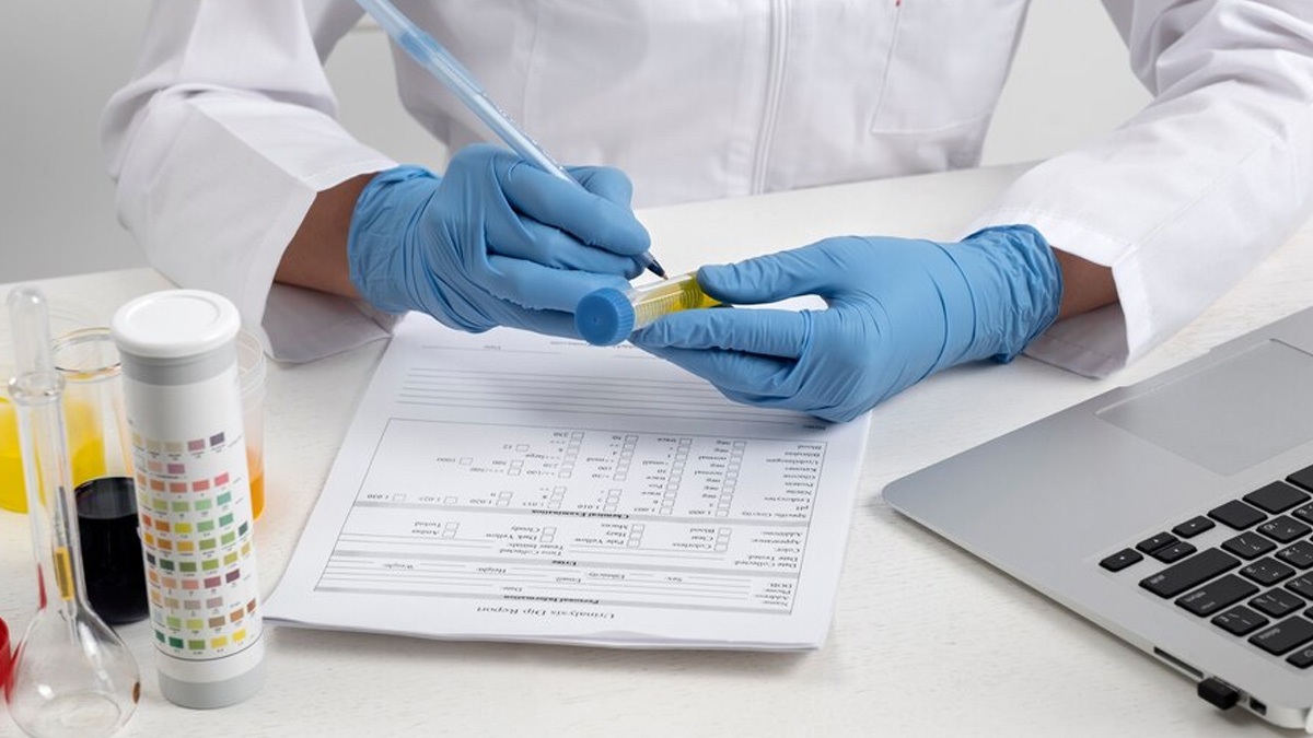 What is Anti CCP Test in Hindi