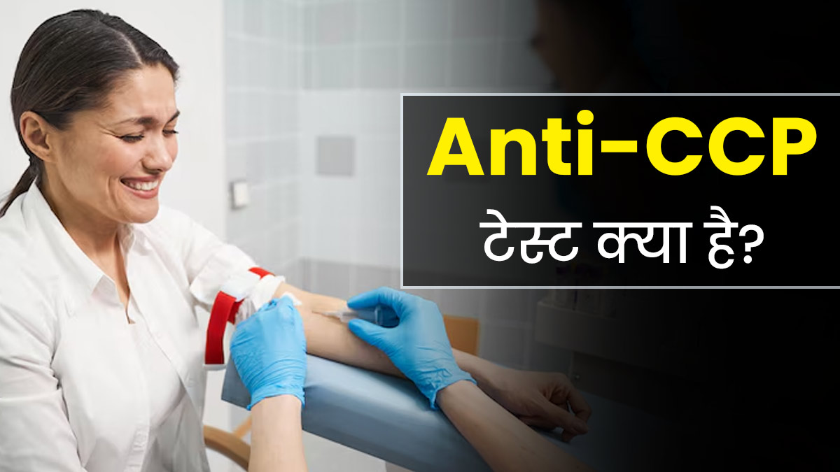 ऑटोइम्यून डिसऑर्डर समेत कई स्थितियों में किया जाता है Anti-CCP टेस्ट? जानें इसके बारे में