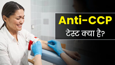ऑटोइम्यून डिसऑर्डर समेत कई स्थितियों में किया जाता है Anti-CCP टेस्ट? जानें इसके बारे में