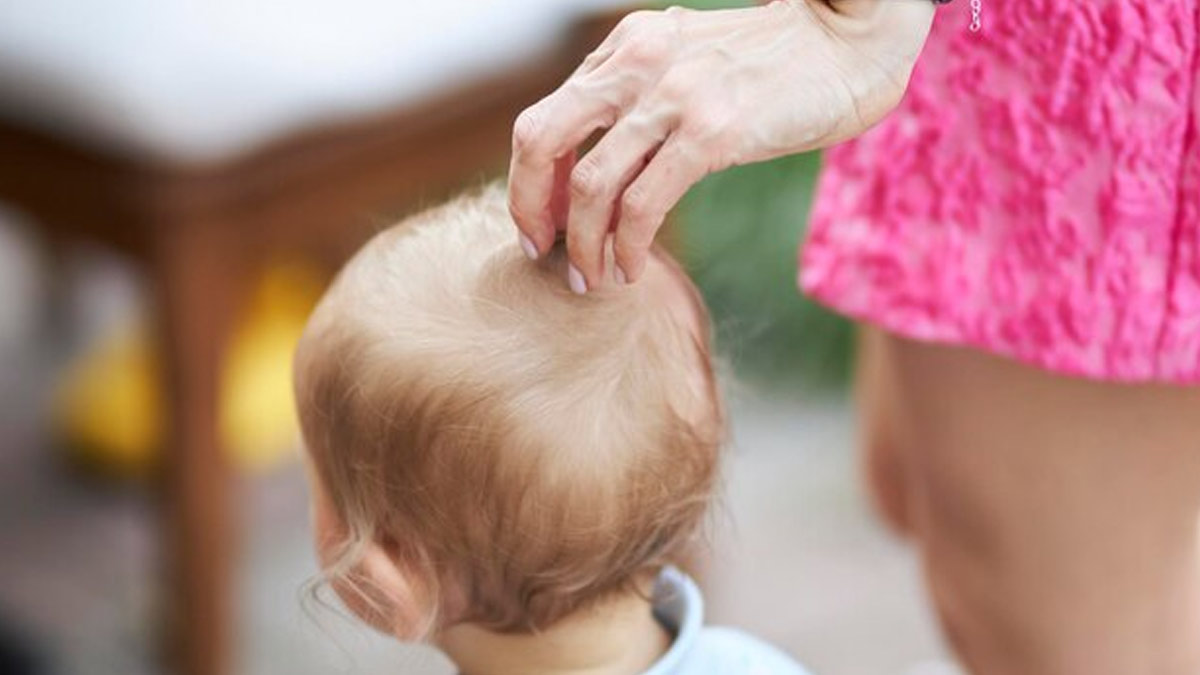 child-hair-loss-inside