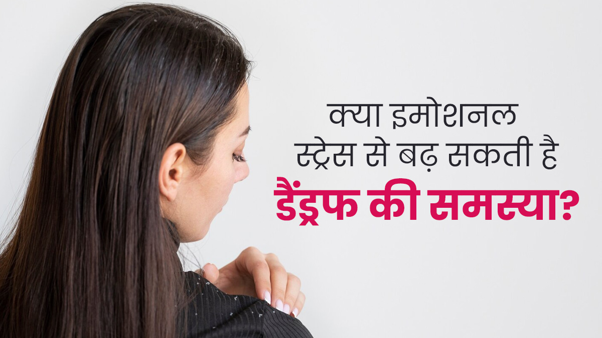 क्या इमोशनल स्ट्रेस से बढ़ सकती है डैंड्रफ की समस्या? एक्सपर्ट से जानें इनका संबंध