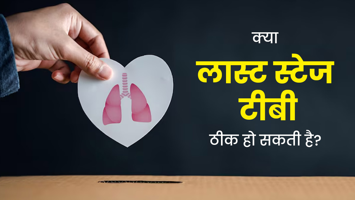 क्या लास्ट स्टेज टीबी ठीक हो सकती है? डॉक्टर से जानें इलाज