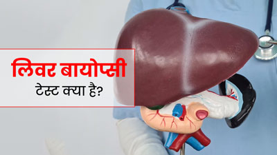 लिवर बायोप्सी टेस्ट क्या है? जानें कब पड़ती है इसकी जरूरत