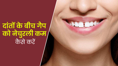 क्या आपके दांतों के बीच भी गैप है? जानें इस गैप को कम करने के लिए 4 टिप्स