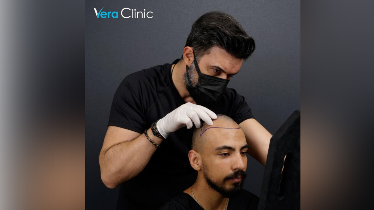 The Unmatched Benefits of Getting Your Hair Transplant Surgery Done in Istanbul