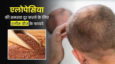 पुरुषों में एलोपेसिया की समस्या दूर करेंगे हलीम के बीज, डाइट में करें शामिल