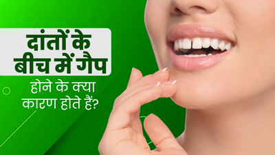 दांतों के बीच गैप क्यों होता है? डॉक्टर से जानें इसके कारण 