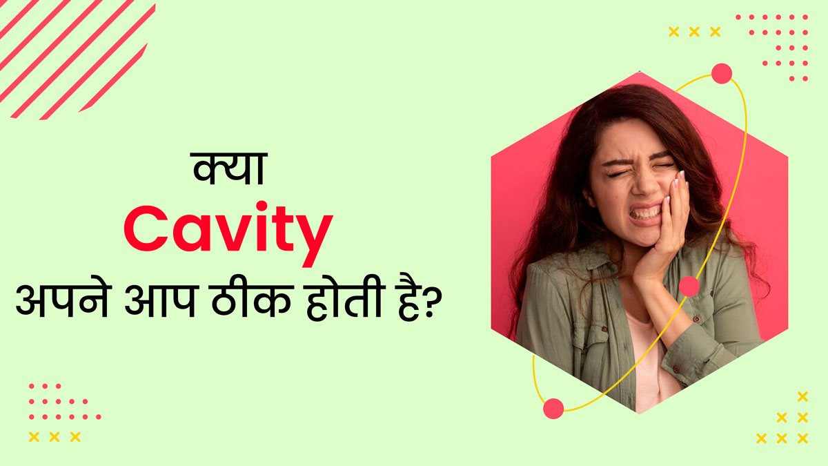 Cavity: क्या वाकई कैविटी बिना इलाज के ठीक हो सकती है? जानें एक्सपर्ट की राय