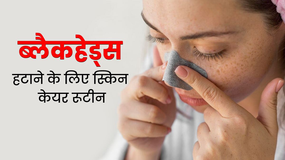 ब्लैकहेड्स और व्हाइटहेड्स से छुटकारा पाने के लिए फॉलो करें ये स्किनकेयर रूटीन, डेड स्किन सेल्स होंगे रिमूव