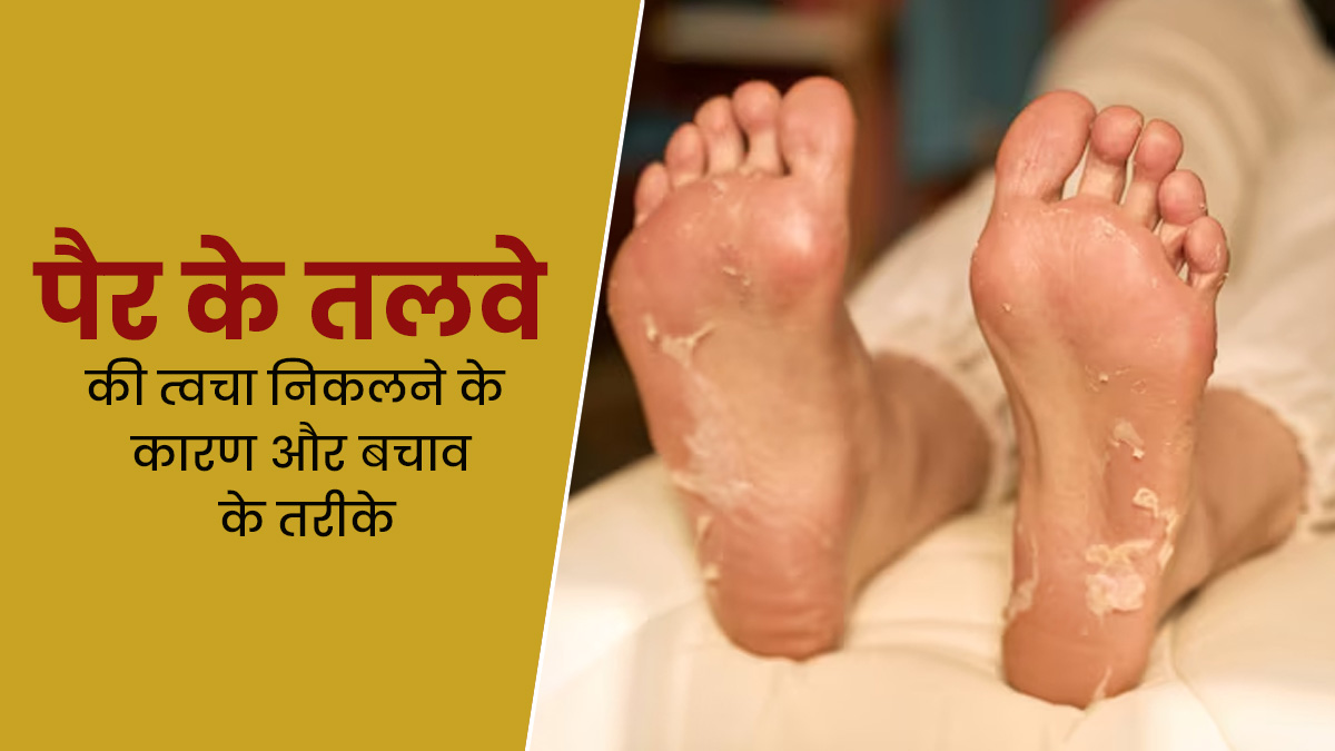 बारिश के मौसम में निकलती है पैरों के तलवों और उंगलियों की स्किन? तो जानें इसके कारण और बचाव के तरीके