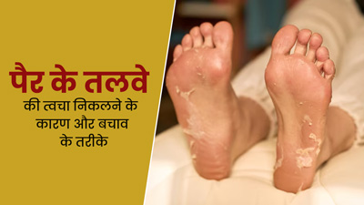 बारिश के मौसम में निकलती है पैरों के तलवों और उंगलियों की स्किन? तो जानें इसके कारण और बचाव के तरीके