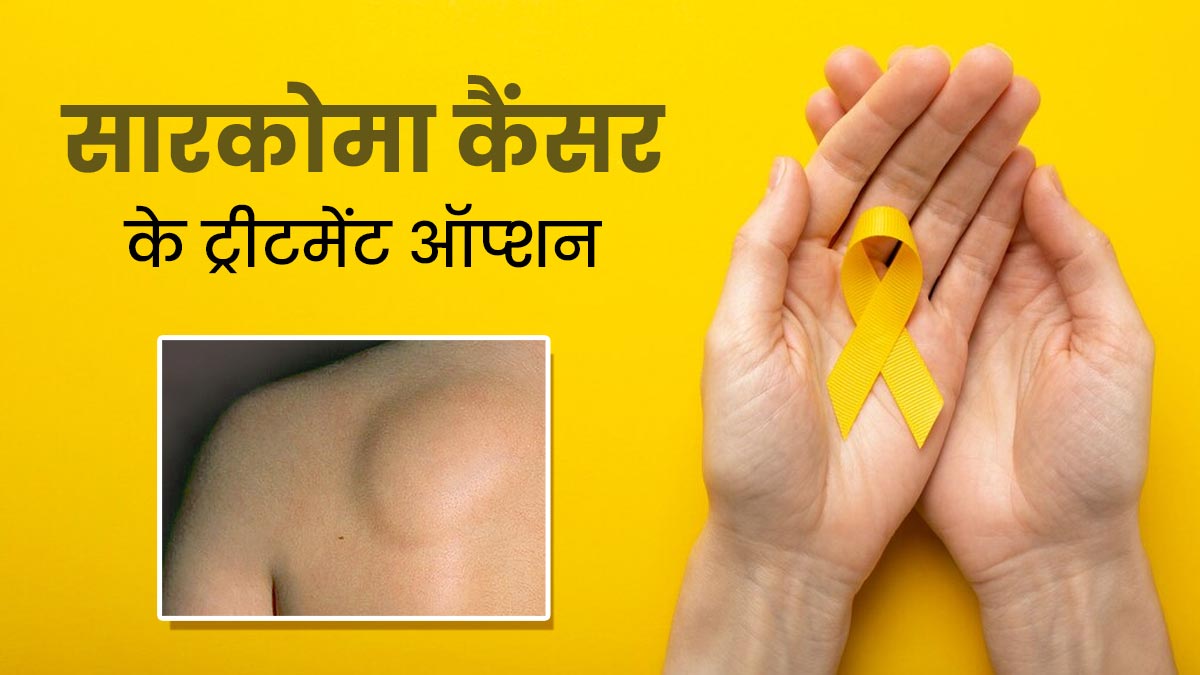 Sarcoma Cancer: सारकोमा कैंसर क्या है? जानें इससे पीड़ित महिलाओं के लिए इलाज के विकल्प