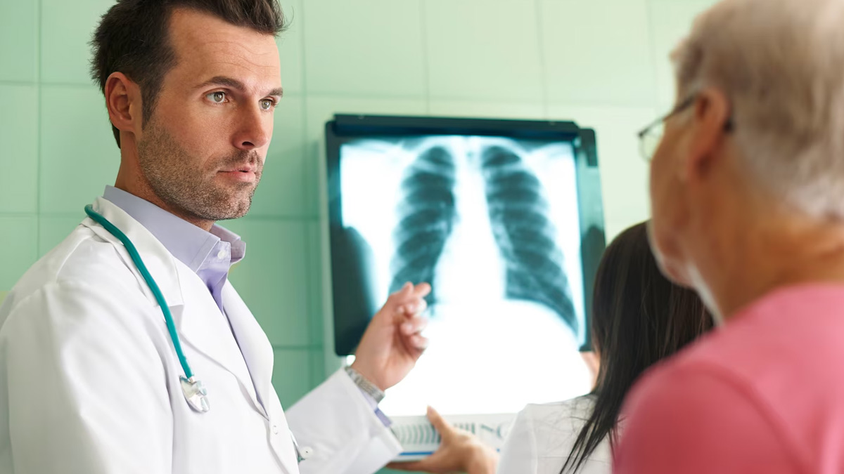 myths and facts about lung cancer