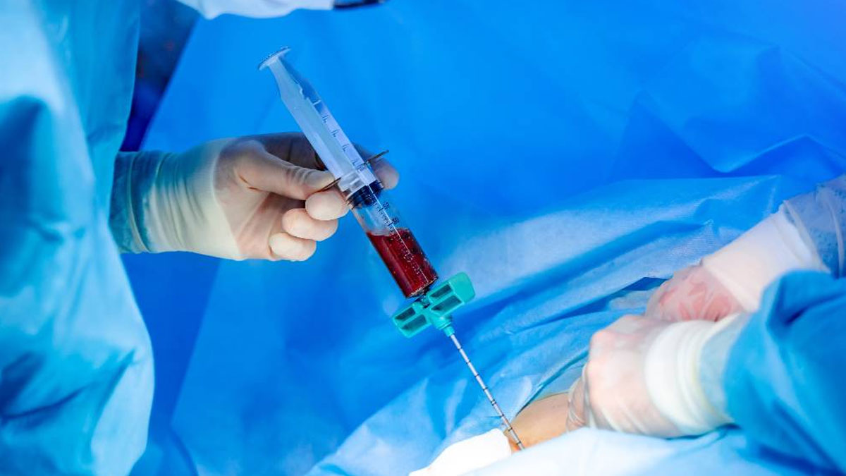 First Successful Paediatric Allogeneic Bone Marrow Transplant In Bengaluru; Know All About The Procedure