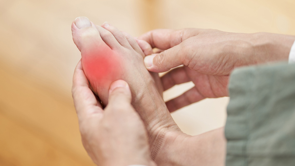 Gout In The Foot: Expert Explains Symptoms, Causes, Risk Factors, And Treatment