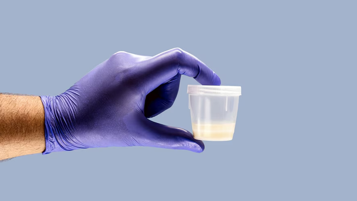 What Is Seminal Plasma Hypersensitivity? Here Are Symptoms, Diagnosis, Treatment Of Semen Allergy