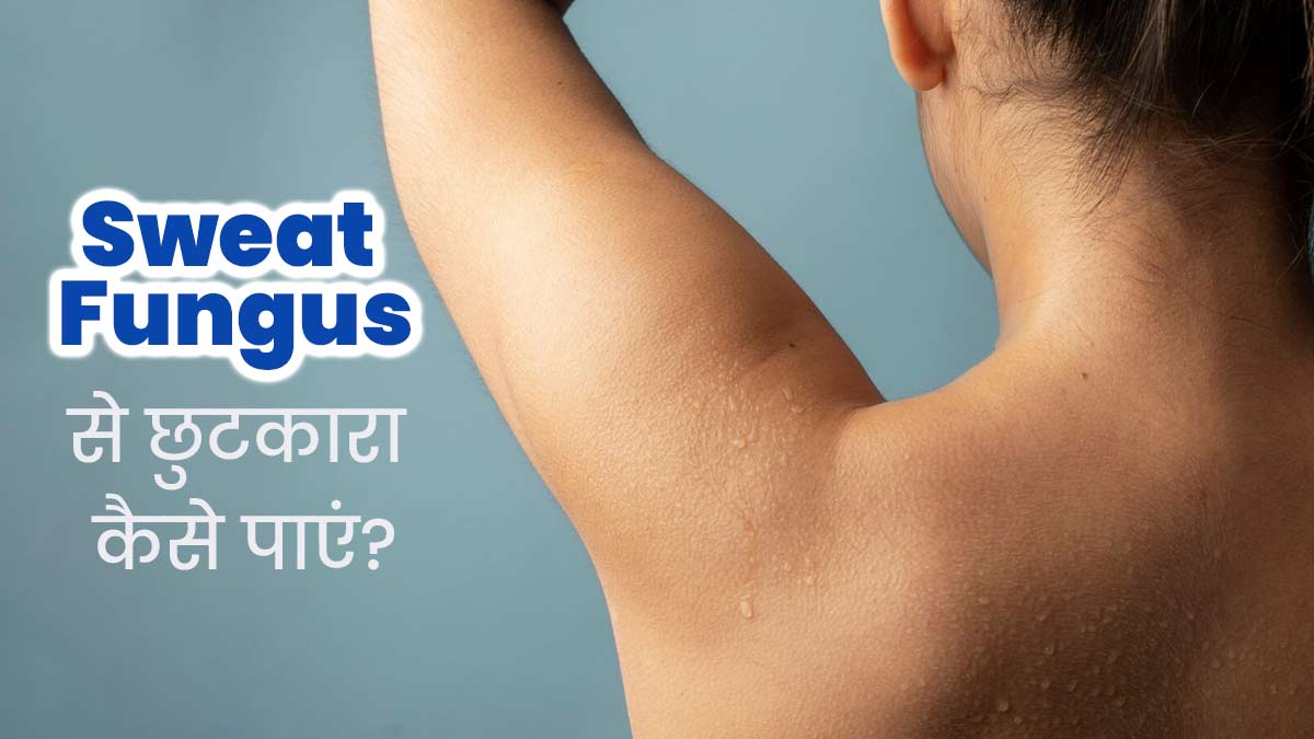 Sweat Fungus: पसीने के कारण फंगल इंफेक्शन से छुटकारा पाने के लिए अपनाएं ये 5 उपाय, जल्द मिलेगा आराम