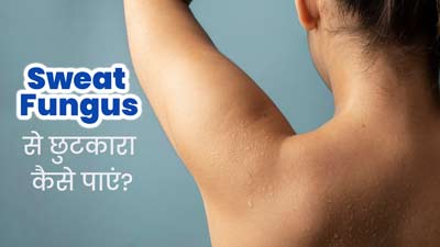 Sweat Fungus: पसीने के कारण फंगल इंफेक्शन से छुटकारा पाने के लिए अपनाएं ये 5 उपाय, जल्द मिलेगा आराम