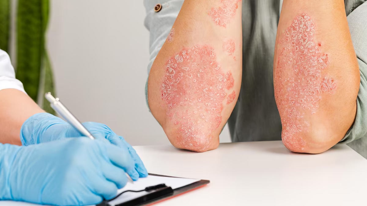 Do You Have Eczema? Practice These Measures After Hair Removal To Protect Your Skin