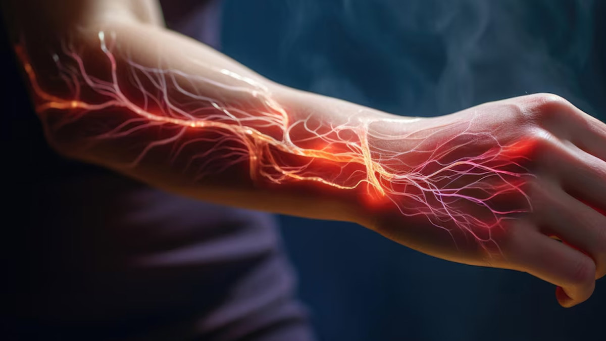 Possible Causes Of Nerve Pain And How To Treat It | OnlyMyHealth