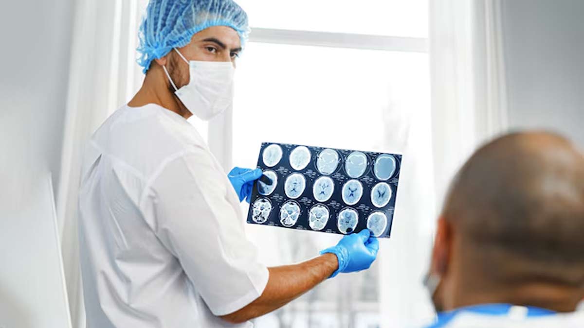 depression increase stroke risk