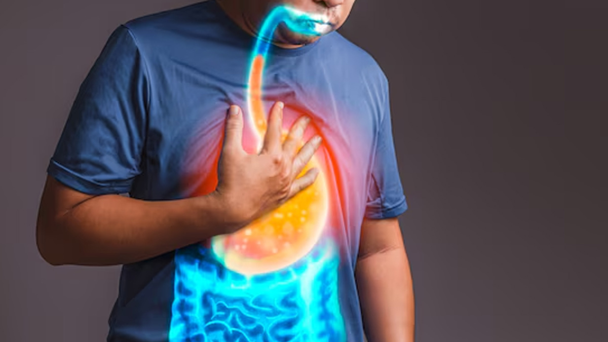 Do Apples Relieve Or Cause Acid Reflux? OnlyMyHealth