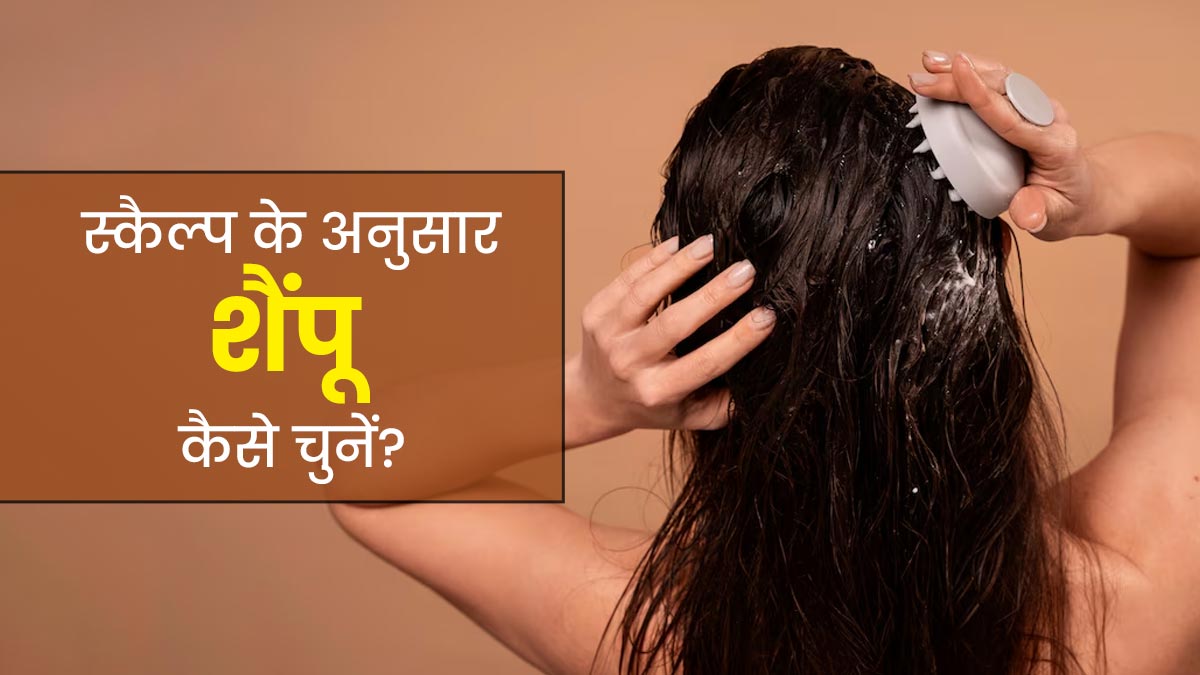 स्कैल्प टाइप के अनुसार इस्तेमाल करें शैंपू, बालों से जुड़ी समस्याएं होंगी कम