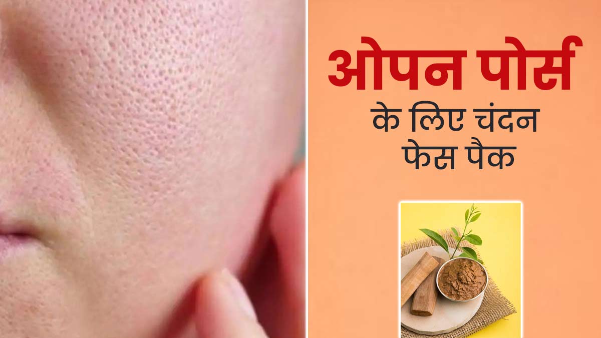 ओपन पोर्स की समस्या से छुटकारा पाने के लिए लगाएं चंदन के ये 4 फेस पैक