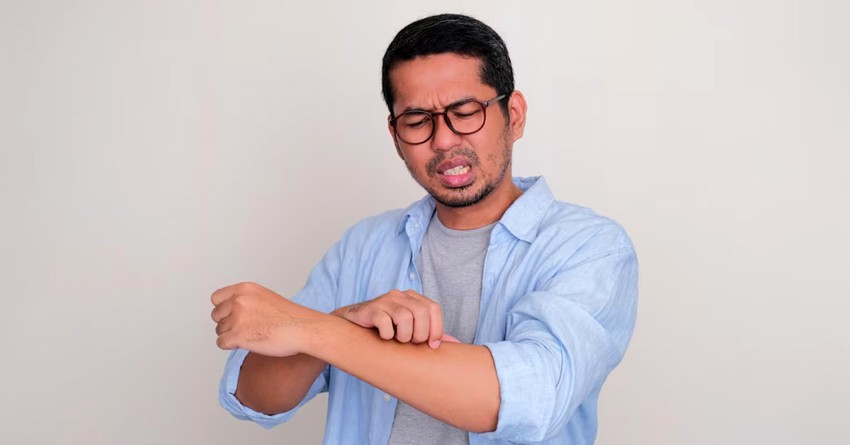 sun exposure itching