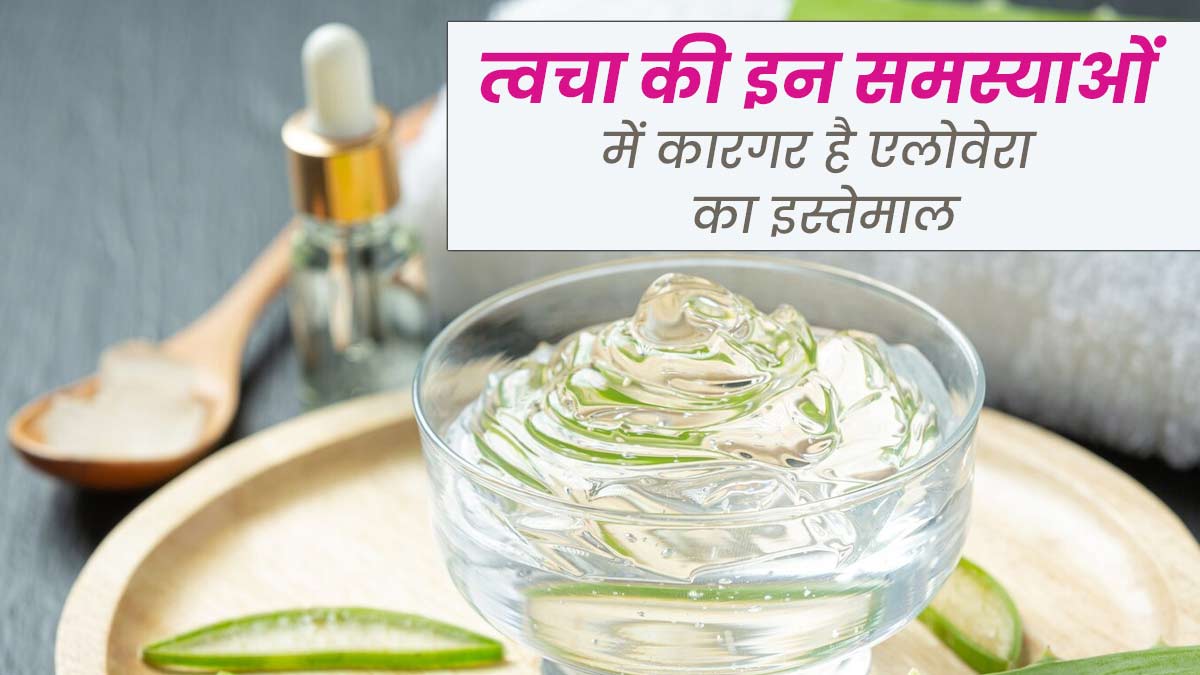 गर्मियों में त्वचा से जुड़ी इन 4 समस्याओं को दूर करेगा एलोवेरा, जानें इस्तेमाल का तरीका