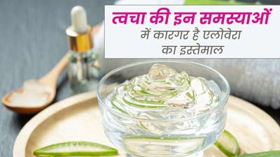 गर्मियों में त्वचा से जुड़ी इन 4 समस्याओं को दूर करेगा एलोवेरा, जानें इस्तेमाल का तरीका