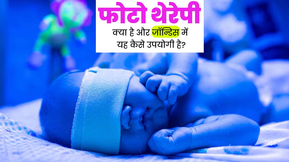 Phototherapy: फोटो थेरेपी क्या है? जानें पीलिया रोगियों के लिए कैसे है यह फायदेमंद?