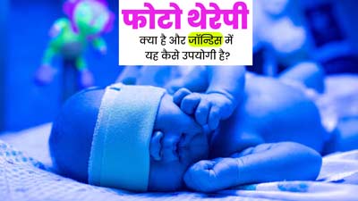 Phototherapy: फोटो थेरेपी क्या है? जानें पीलिया रोगियों के लिए कैसे है यह फायदेमंद?