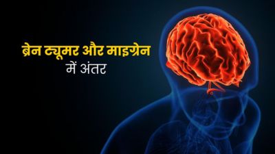 लगभग एक जैसे ही दिखते हैं ब्रेन ट्यूमर और माइग्रेन के लक्षण, जानें अंतर और बचाव