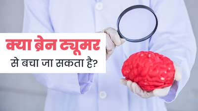 World Brain Tumour Day: देश में लगातार बढ़ रहे हैं ब्रेन ट्यूमर के मामले, जानें इससे बचने के उपाय