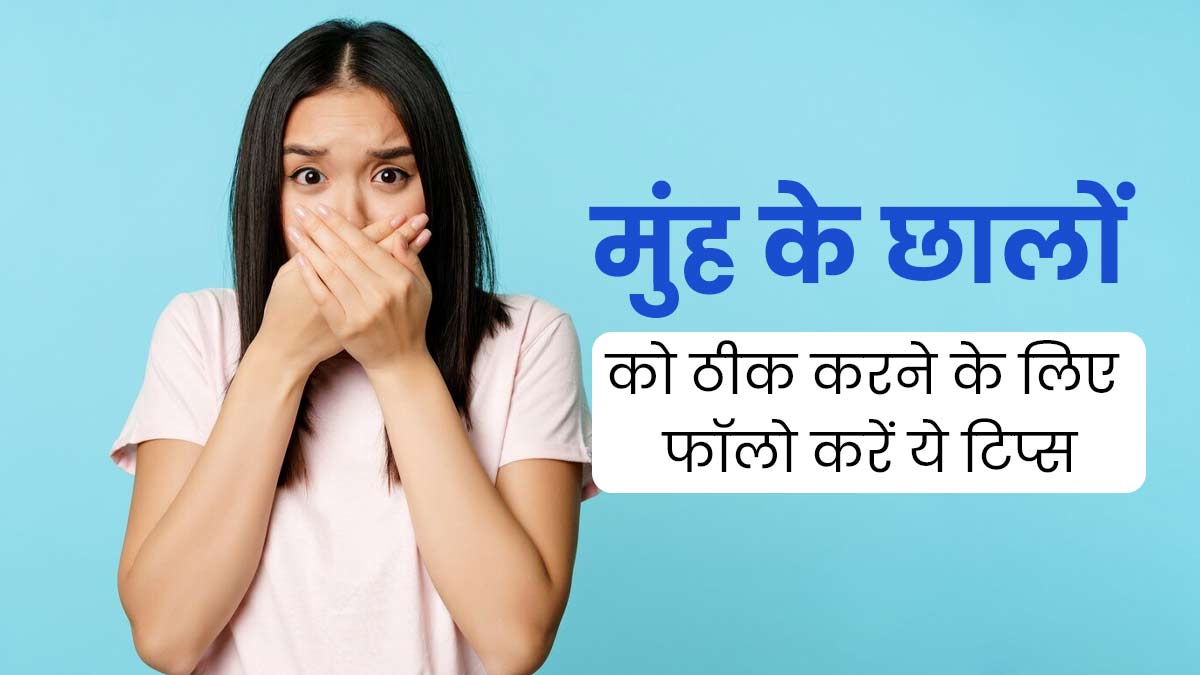 मुंह के छालों से परेशान हैं तो फॉलो करें ये 5 टिप्स, मिलेगी राहत