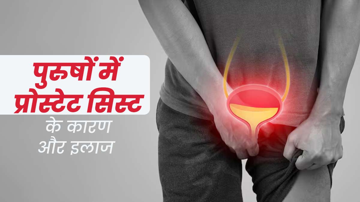 प्रोस्टेट सिस्ट की समस्या क्यों होती है? जानें इसके कारण और इलाज का तरीका  