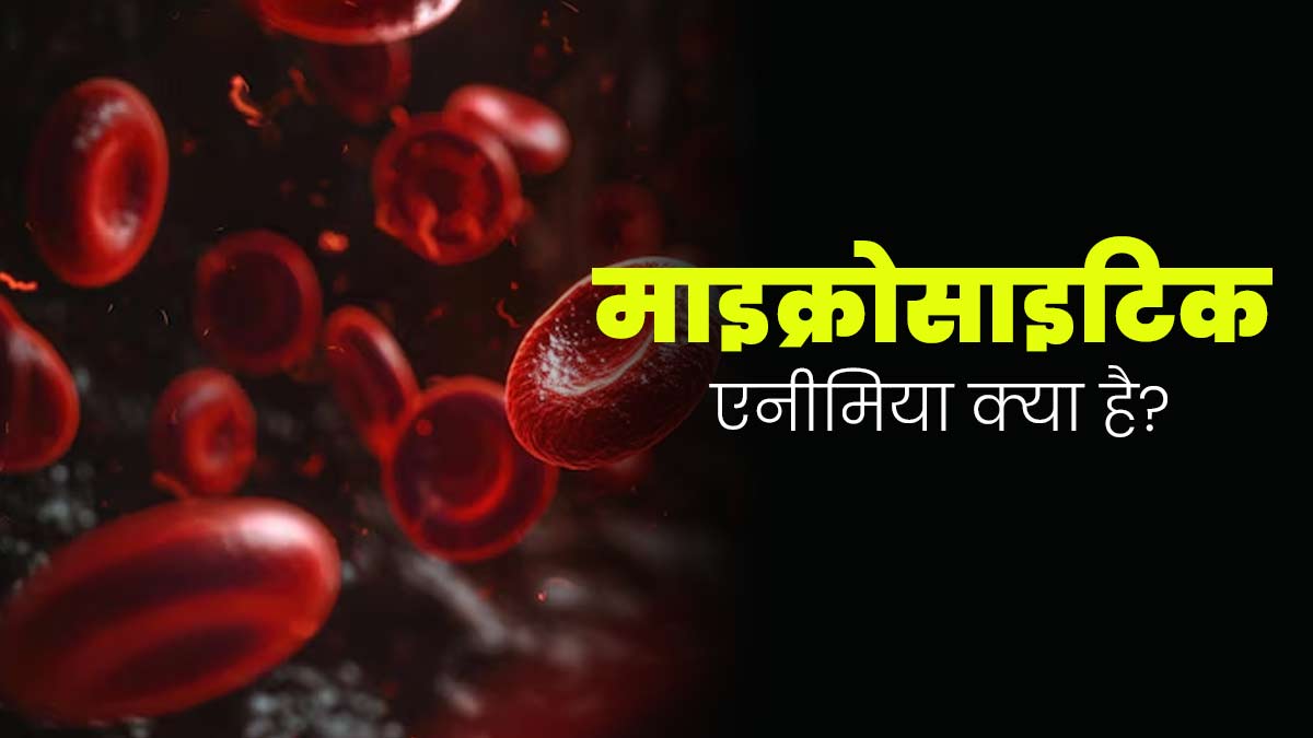 माइक्रोसाइटिक एनीमिया क्या है? डॉक्टर से जानें इस बीमारी के लक्षण और बचाव के उपाय