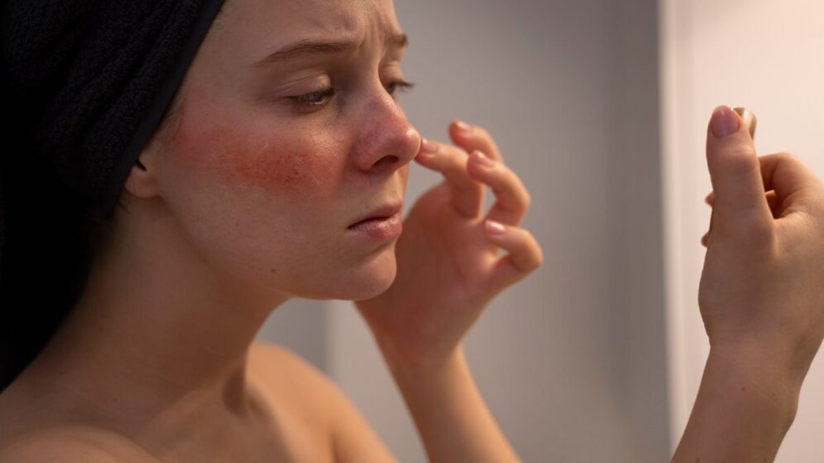 High Salt Intake Can Increase The Risk Of Skin Inflammation: The Tips Can Help You Mitigate The Impact