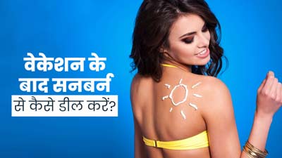 वेकेशन के बाद हो गई है सनबर्न की समस्या? जानें इससे छुटकारा पाने के उपाय