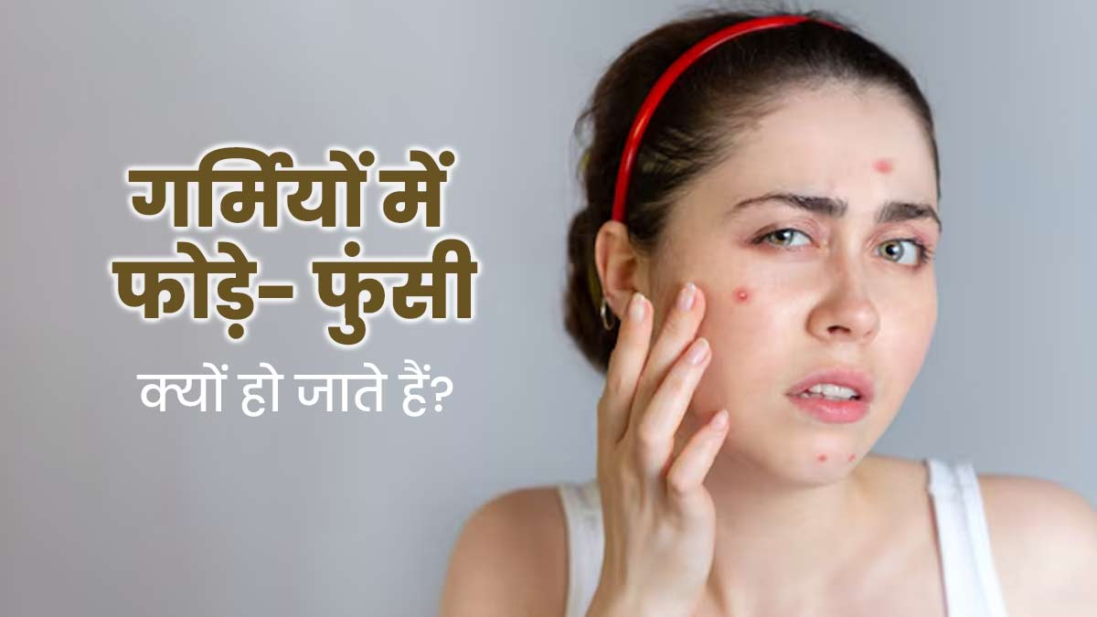 गर्मियों में फोड़े-फुंसी क्यों हो जाते हैं? जानें इसके कारण और बचाव के उपाय