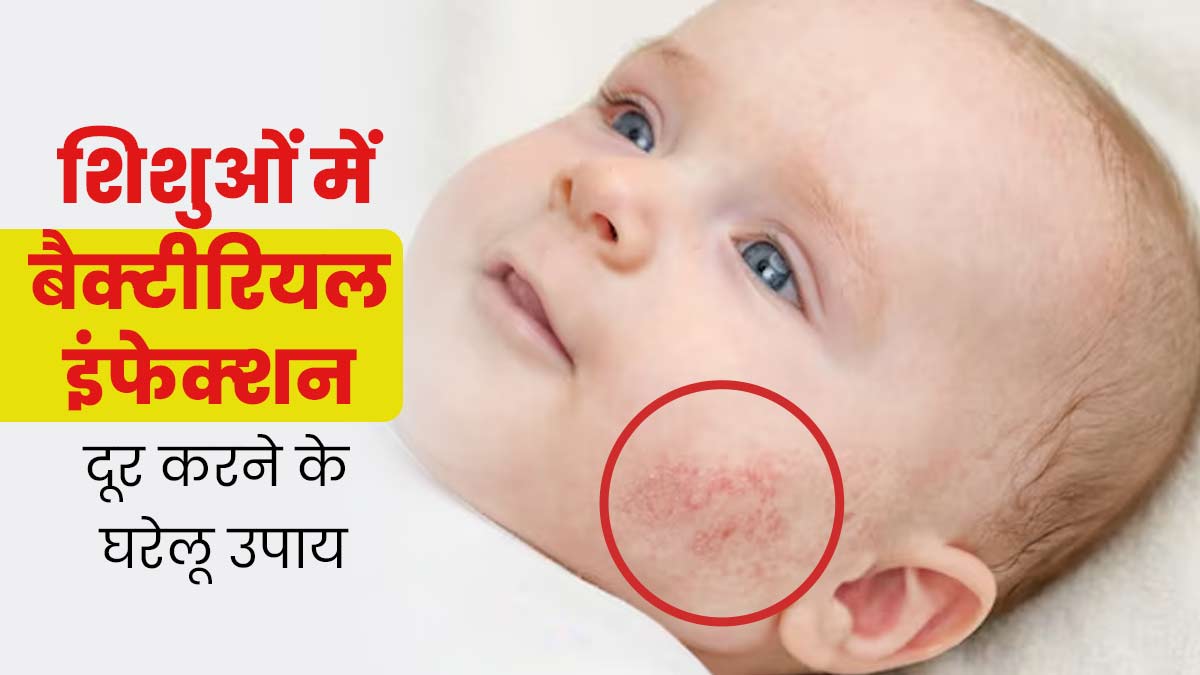 गर्मियों में श‍िशुओं को अक्‍सर हो जाता है बैक्टीरियल इंफेक्शन, राहत के ल‍िए अपनाएं ये 5 घरेलू उपाय