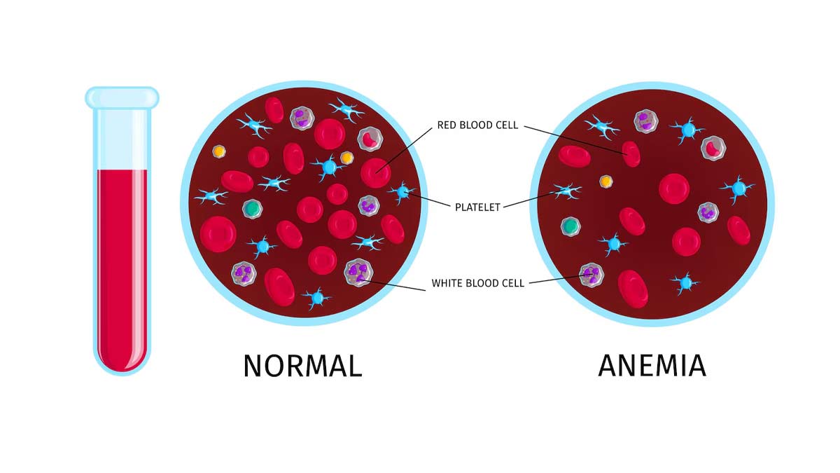 low mch level in hindi