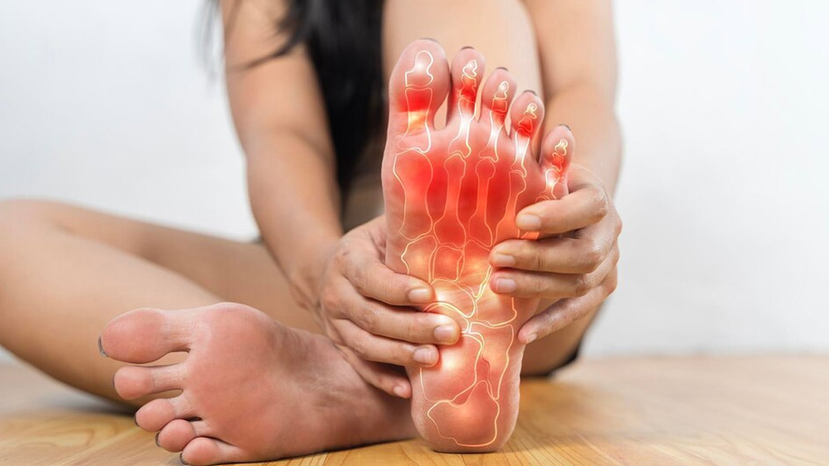 Gout Prevention: How To Naturally Lower Uric Acid Levels In The Body