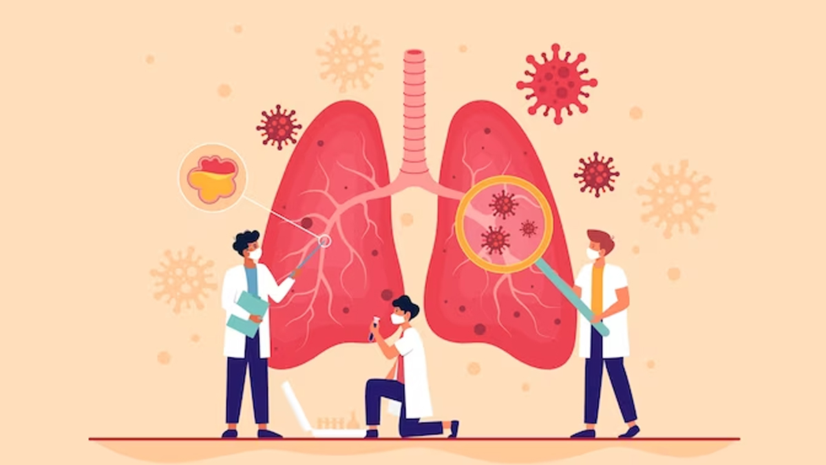 How Tuberculosis Is Transmitted in Hindi