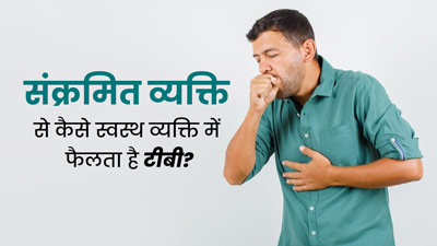 संक्रमित व्यक्ति से कैसे स्वस्थ व्यक्ति में फैलता है टीबी? समझें डॉक्टर से