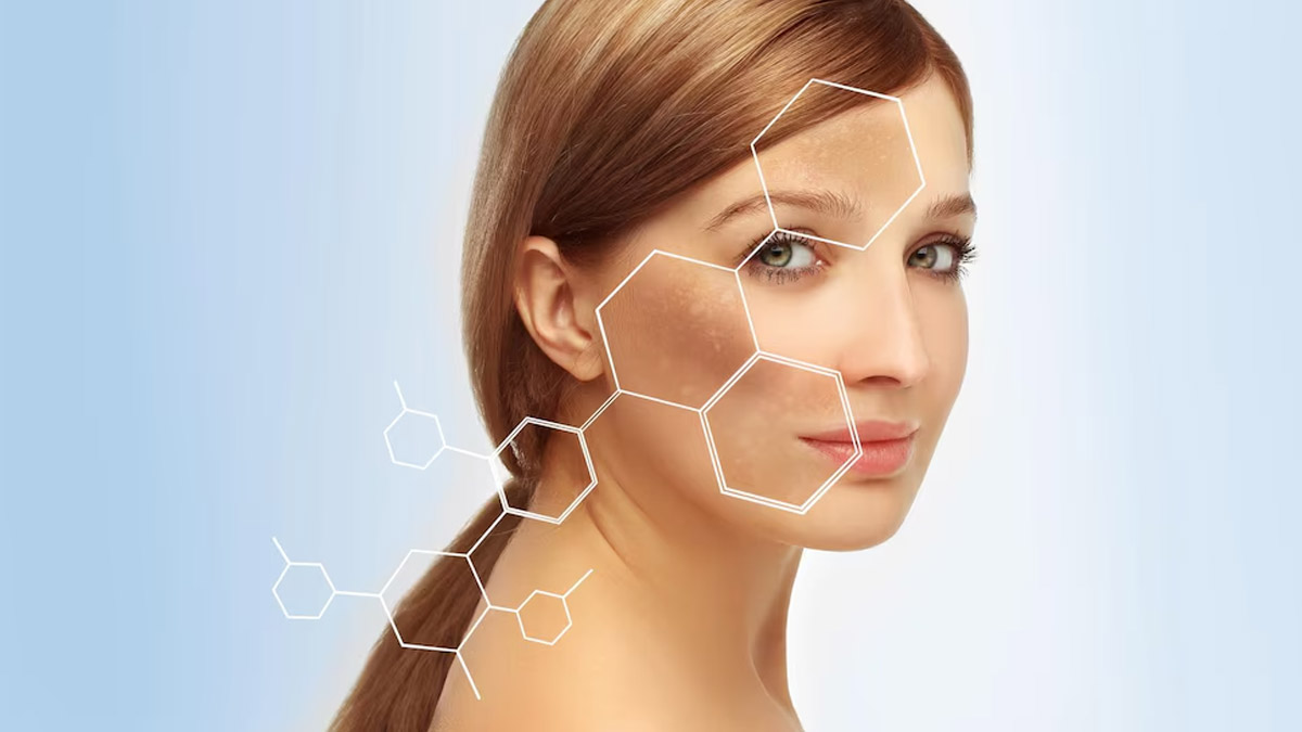 What Are The Causes Of Postpartum Hyperpigmentation? Ways To Reduce It